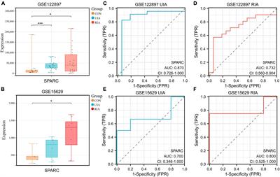 Secreted protein acidic and rich in cysteine (SPARC) induces apoptosis of human brain vascular smooth muscle cells through regulating HK2 in intracranial aneurysm